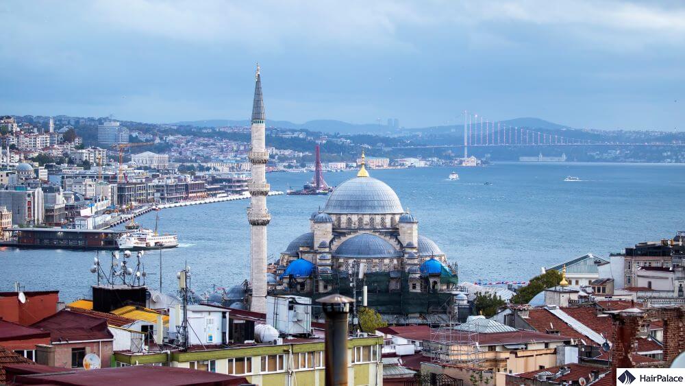 turkey hair transplant